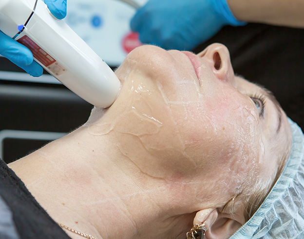 Non-Surgical Neck Lift in Turkey