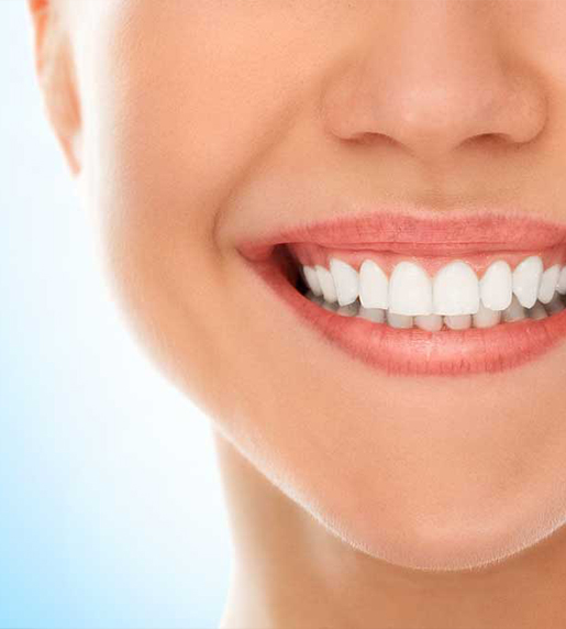 Hollywood Smile