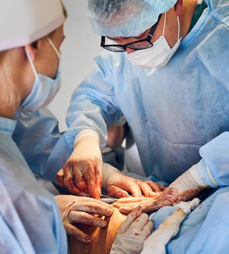 Cancer Surgery