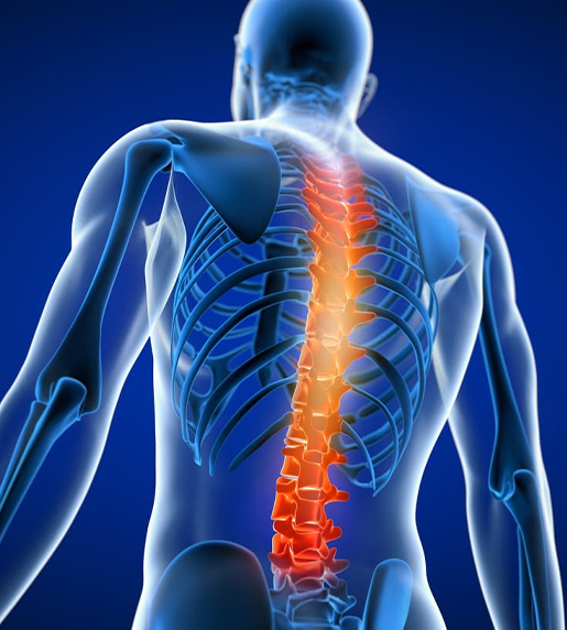 Spinal Surgery