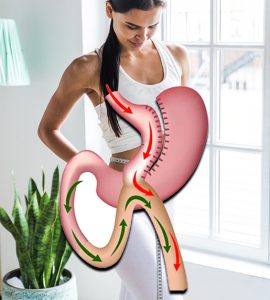 Bariatric Surgery