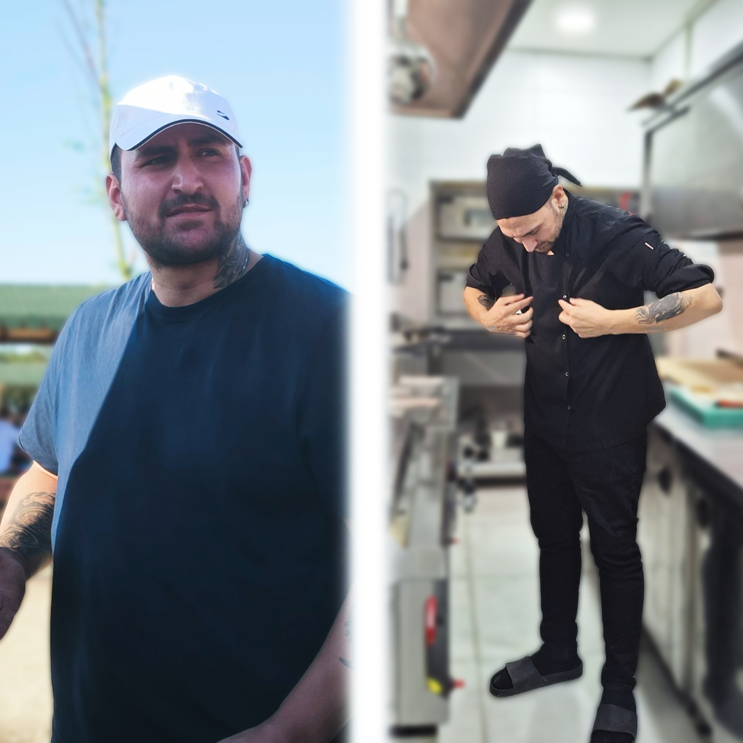 Impressive gastric sleeve results