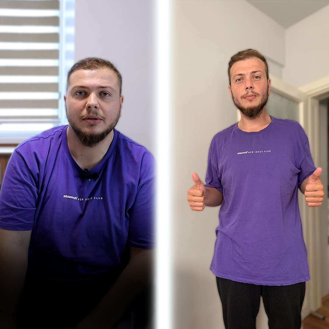 Bariatric surgery results – gastric sleeve transformation