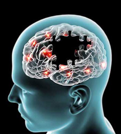 Treatment of Movement Disorders and Brain Battery